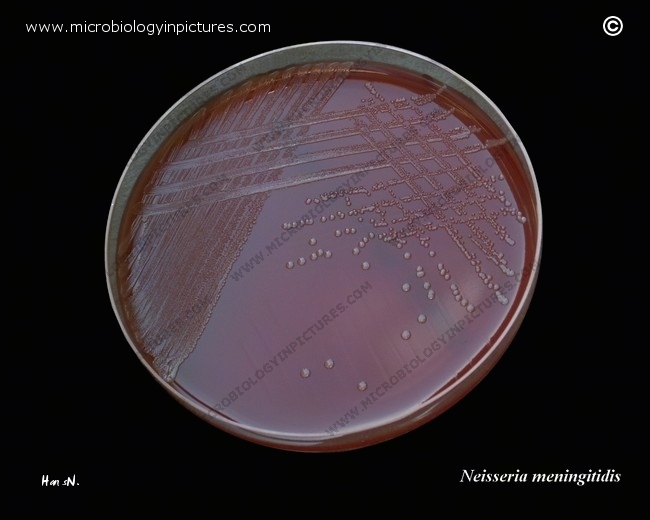 neisseria meningitidis on blood agar plate